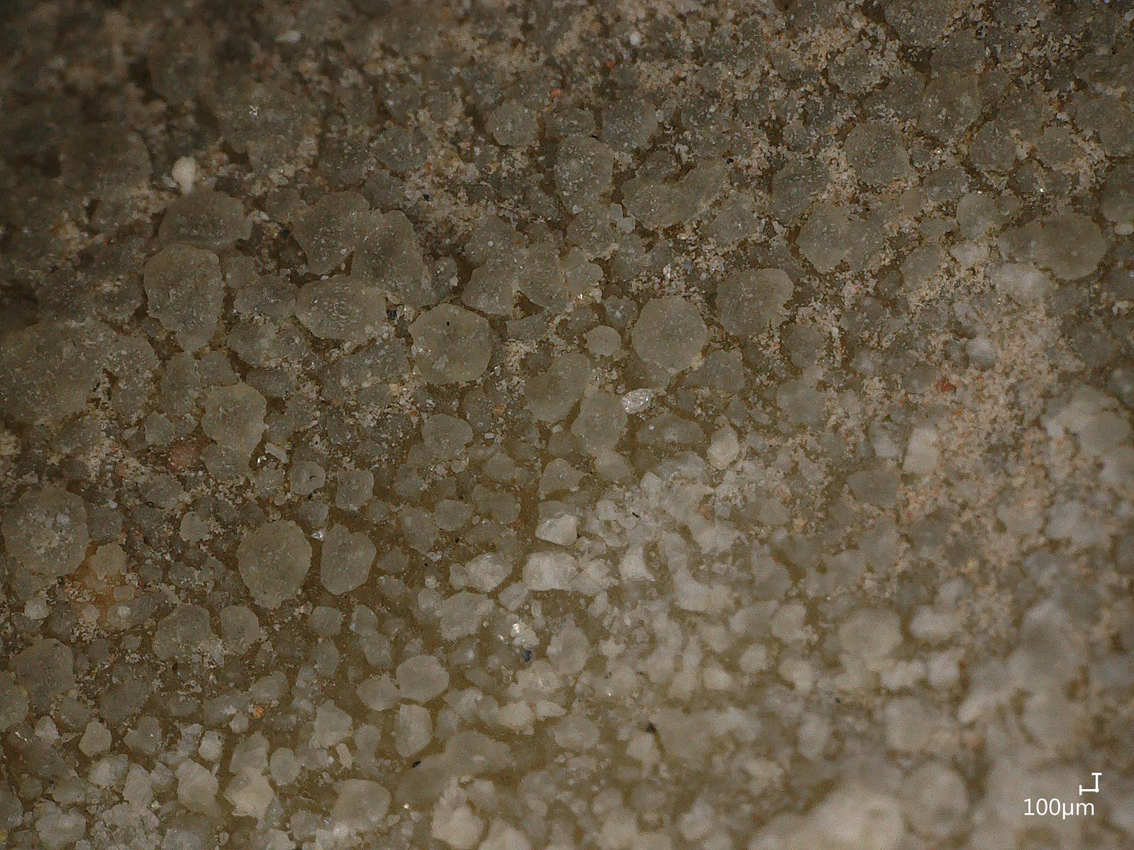 Croûte noire vue au microscope 3D