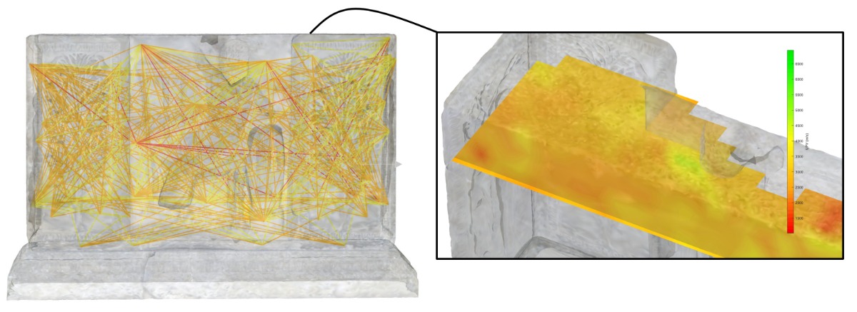 Auscultation acoustique